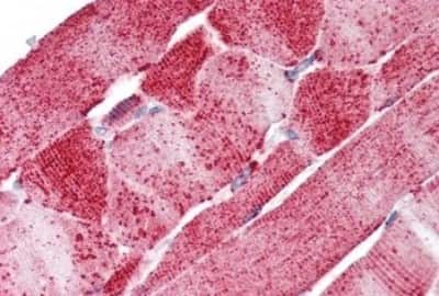 Immunohistochemistry-Paraffin: SMVT/SLC5A6 Antibody [NBP3-14478] - Immunohistochemistry of formalin-fixed, paraffin-embedded human skeletal muscle after heat-induced antigen retrieval.